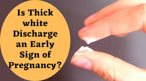 Milky discharge after ovulation if pregnant. White Discharge à¤• à¤¯ à¤¹ à¤¤ à¤¹ Leucorrhoea Cause Treatment Home Remedy For White Discharge Youtube