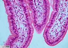 Simple cuboidal epithelium this kind of epithelium functions in two distinctive ways depending on its location. Simple Columnar Epithelium Description Single Layer Of Elongated Cells Function Protection Secretion And Absor Tissue Types Human Tissue Cells And Tissues