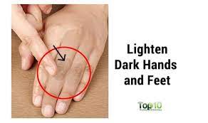 As Our Hands And Feet Remain Exposed Most Of The Time They Have A Tendency To Get Darker Than The Skin On Other Lighten Skin Dry Skin On Feet Dry Skin