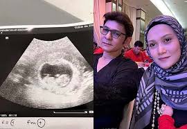 Demikianlah daftar jenis dan nama nama dinosaurus yang paling terkenal lengkap beserta foto dan gambar dinosaurus. Artis Malaysia Azura Akan Cecah 7 Bulan Isteri Jamal Facebook