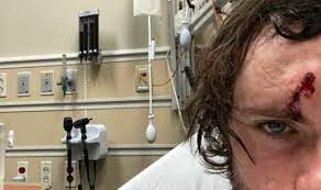 You can hear it whistling. Man Is Lucky To Be Alive After Accidentally Shooting Himself In The Head With 50 Calibre Gun