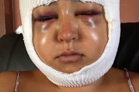 Fundraiser by Naya Marie Velazco : Gender Affirming Surgery Trans Visibility