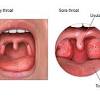 You would find one in the lower half of the neck. 1