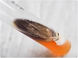 Aspergillus are found in millions in pillows. What Is Aspergillus Niger