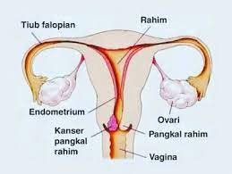 Cara menanam dan merawat bunga calla lily di pot akan tetapi, bila tanaman kembang sepatu tidak menghasilkan kuncup atau tidak berbunga, maka cobalah untuk memindahkannya ke area yang mendapat lebih banyak sinar matahari. Cara Merawat Rahim Kembang Jamu Dewi Seri Premium Facebook