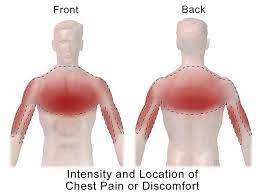Common causes of chest pain. File Heart Attack Chest Pain Png Wikipedia