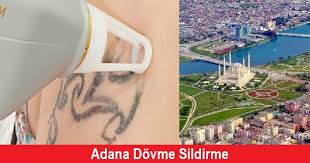 Adana Dovme Sildirme Fiyatlari Lazer Epilasyonu Lazer Epilasyon Fiyatlari Merkezleri Ve Cihazlari
