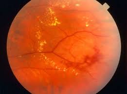 Image result for Chorisochora transvaalensis