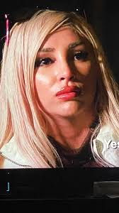 I'm watching Yeaterdays episode when Sally & Chloe were chatting … is it me  or did Sally's lips seem extremely plump? I think she is beautiful but I  don't remember her lips