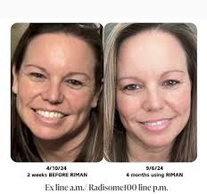 And natures most magical ingredient for all dermatology issues…. 🙏🩷🩷🩷