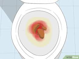 Although blood is the main symptom that is common or blood in your tissue paper following wiping, other signs. 3 Ways To Recognize Colon Cancer Symptoms Wikihow