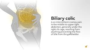Image result for Biliary Colic