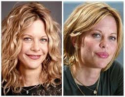 Meg Ryan Plastic Surgery Before And After Botox Facelift Bad Plastic Surgeries Cosmetic Surgery Plastic Surgery Gone Wrong