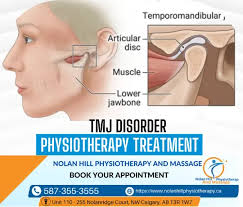 TMJ Physiotherapy Calgary