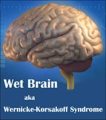What Is Wet Brain Wernicke Korsakoff Syndrome Inspire Malibu