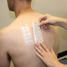 Patch Testing And Contact Dermatitis Slu
