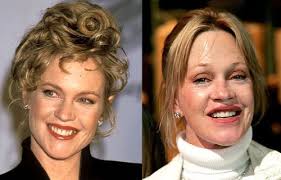 10 Worst Celebrity Plastic Surgeries Botox Jobs Bad Celebrity Plastic Surgery Celebrity Plastic Surgery Melanie Griffith Plastic Surgery