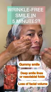 Serie Aida Temporada 6 Cap 1