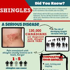 What causes shingles in young adults. Shingles Immunize Bc