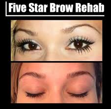 Five Star Brow Rehab If You Have Sparse Eyebrows Due To Over Waxing Or Tweezing We Can Help You This Procedu Wax Hair Removal Diy Beauty Treatments Brows