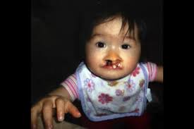 Saanich family unbowed by adopted girl's challenges