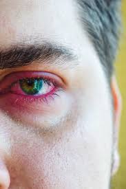 Contact dermatitis is also another possible cause of itchy or flaky eyelids. Sore Eyelid Causes When To See A Doctor And Treatment
