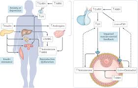 See spelling differences) is an intermediate color between black and white.it is a neutral color or achromatic color, meaning literally that it is a color without color, because it can be composed of black and white. Epigenetic Inheritance Of Polycystic Ovary Syndrome Challenges And Opportunities For Treatment Nature Reviews Endocrinology