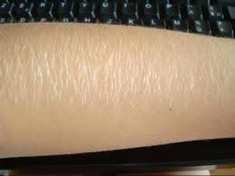 Depuis quelques temps, leurs photos envahissent les réseaux sociaux où elles affichent fièrement leur pilosité. Decoloration Des Poils Comment Ca Marche Epilateur Et Epilation