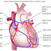 The most common arteries diagram material is paper. 1