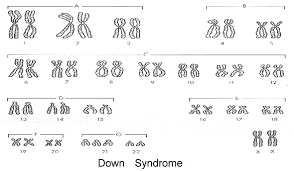 Different chromosomal ploidies are also, however, known to occasionally occur. Chromosomes And Dna