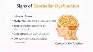 Image result for Rapid Alternating Movements