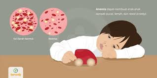 Lampu di atas pencampuran kapiler pendek lain dengan tanda berukir (11,0 di sel. Anemia Pada Anak Tanda Dan Gejala Penyebab Cara Mengobati Cara Mencegah