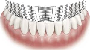 Image result for Occlusal