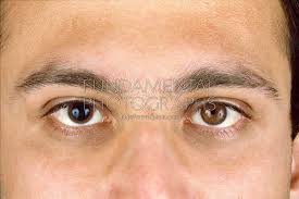 نتیجه جستجوی لغت [constricted] در گوگل