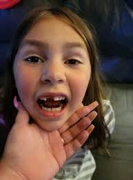 LuLu pulled her tooth and we had a day where 2 girls lost a tooth