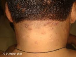 Pin On Health