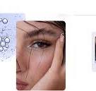 Hyamax Aesthetic Solutions | Dermal Filler Treatments