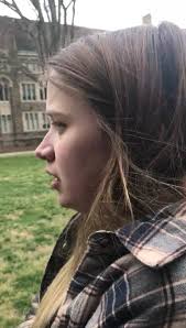 Yesterday, 28 year old CF fighter, Linsday Bishop, had her second  double-lung transplant at Toronto General Hospital. After chronic rejection  of her first lung transplant, Lindsay bravely underwent a second and the