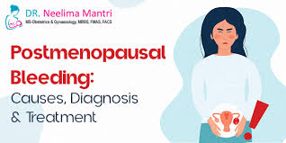 Image result for Postmenopausal Bleeding
