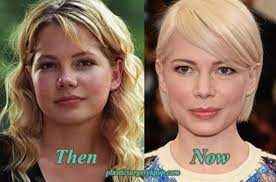 Michelle Williams Plastic Surgery Before And After Pictures Plastic Surgery Cosmetic Surgery Michelle Williams
