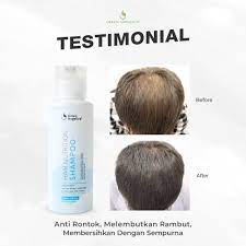 Shampo Penumbuh Rambut Herbal Mengatasi Rambut Rontok Anti Ketombe 100 Halal Bpom Green Angelica Hair Shampoo Sampo Rambut Rontok No 1 Di Indonesia Sampo Ketombe Rambut Rontok