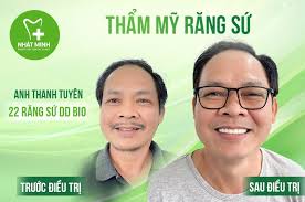 HỆ THỐNG TRUNG TÂM NHA KHOA NHẬT MINH