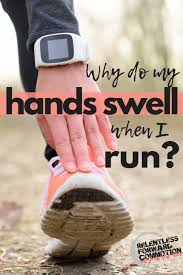 Why Do My Hands Swell When I Run Relentless Forward Commotion