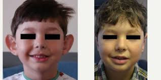 John B. Lazor, MD, MBA, FACS, Board Certified Facial Plastic Surgeon