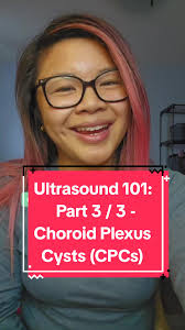 What Causes Fetal Choroid Plexus Cysts