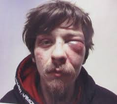 On Sunday, January 16, 2022, Boone County Deputies responded to the Bias  Branch area for a disturbance with shots fired. After an investigation into  the incident, Deputies arrested David Cales, 29 yoa