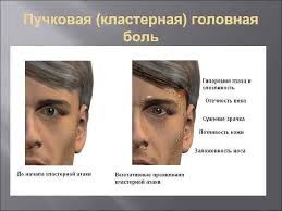 Klasternaya Golovnaya Bol Iz Klinika Lecheniya Boli Facebook