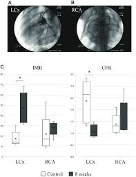 Duplex Ultrasound In Peripheral Arterial Disease | Springerlink