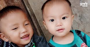 Healing Hope for Baby Hai Quan: A Lifeline for Burn Recovery'