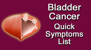 Uterine sarcoma is a rare type that starts in the muscles in the uterus or the surrounding tissue. Bladder Cancer Quick Symptoms List Youtube
